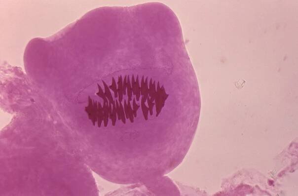Echinococcus vogeli