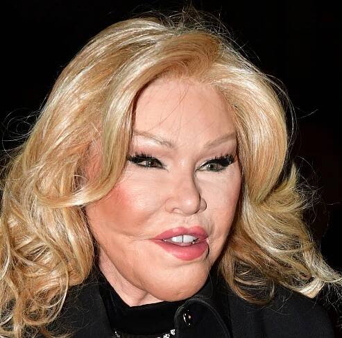 FOTO: Jocelyn Wildenstein se chtěla stát kočičí ženou. – stránka 17