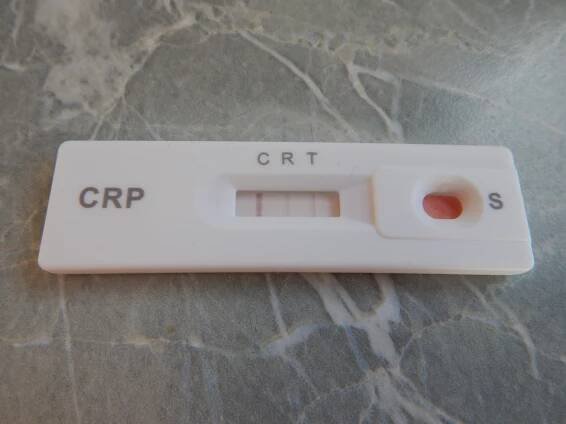 Zkušenosti domácí test CRP - Poradna pro ženy a dívky - WomenZone.cz 