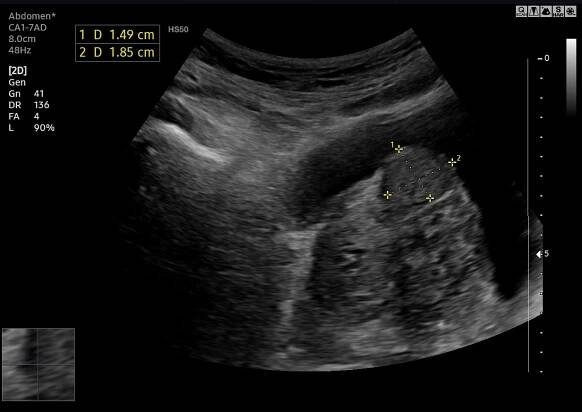 Sono-Atlas - GP Medical Center Westend
