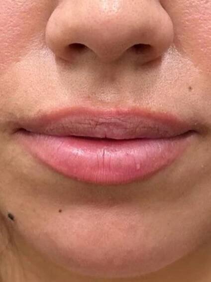 Rebecca Cross, Cosmetic Nurse Injector | Esthetics Center