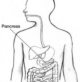 Macromo | Pankreatitida