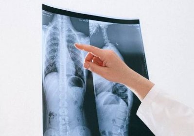 Radiologie? Důležitý pomocník při zjišťování vašich zdravotních problémů – Zdraví