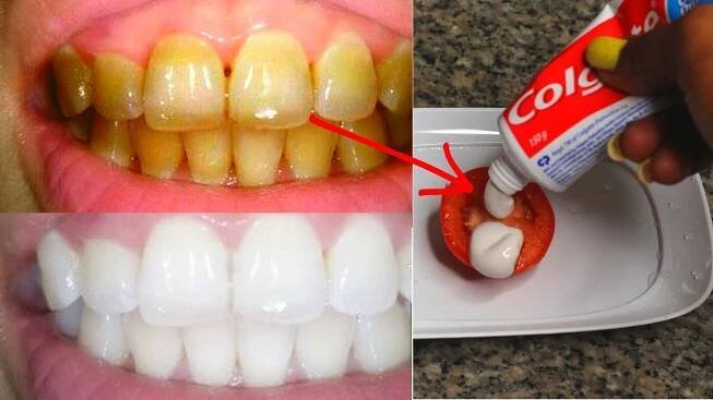 IN 2 MINUTES TURN YELLOW TEETH TO PEARLY WHITE WITH TOMATO