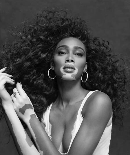 Winnie Harlow; Paul Mitchell campiagn images; credit: Micaiah Carter