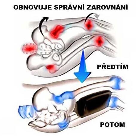 Ortopedický polštář mezi kolena na bolest kyčlí, zad, kloubů a nohou| Deminas
