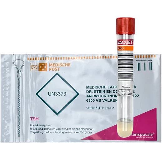 TSH thyroid - Bloodtesting.nl.com