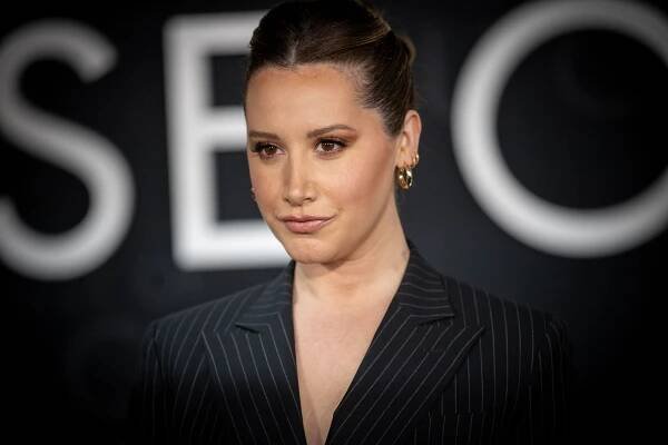 Ashley Tisdale Opened Up About Her Alopecia Diagnosis — See Video