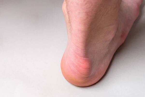 podiatry blog | Frisco Foot & Ankle Specialists