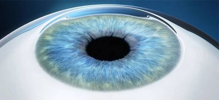 Laserové operace očí | Oční klinika Zlín