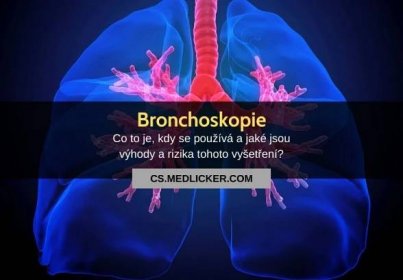 Co je bronchoskopie, jak probíhá a co od ní čekat?
