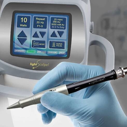 Comparing Surgical Lasers - LightScalpel CO2 Laser Surgery