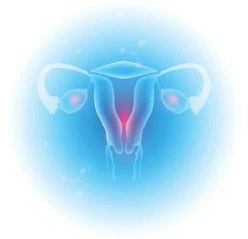 ženské reprodukční orgány - syndrom polycystických ovarií stock ilustrace