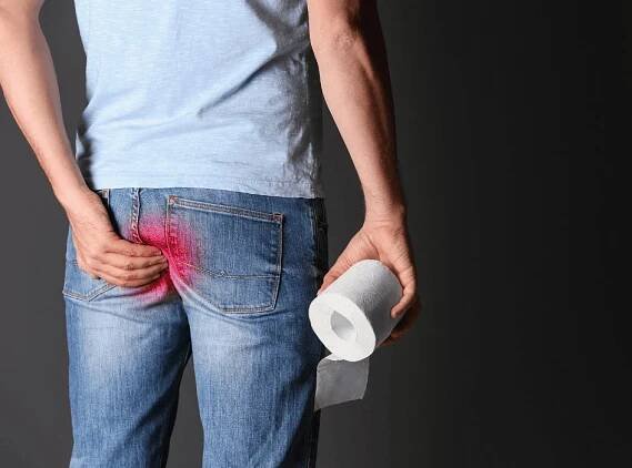 Jaké jsou příznaky a příčiny hemoroidů a jak je léčit? • kompava.cz