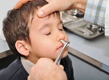 odstranenie nosnej mandle u deti zvolen