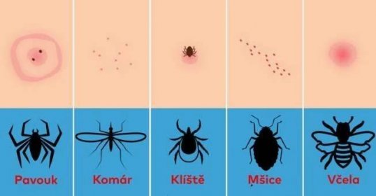 10 štípnutí hmyzem, jak se zachovat při každém jednom z nich: Toto by měl vědět každý! - Prodivky