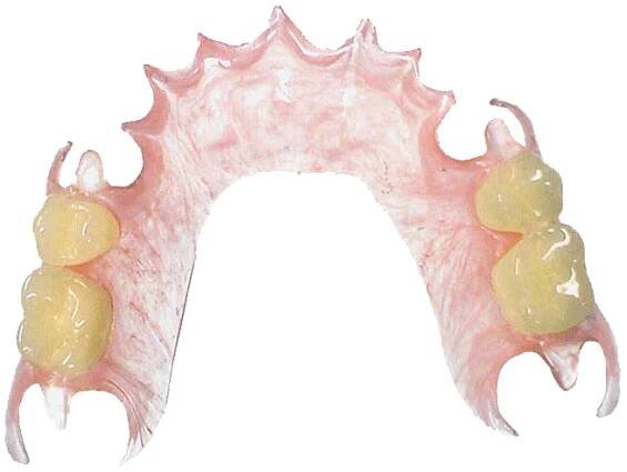 Pružné protézy Deflex - Abekodentist