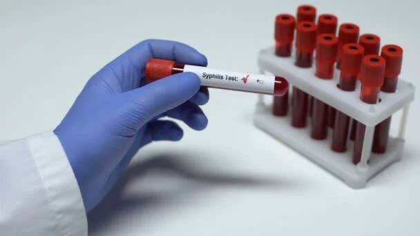Negativní test syfilis, doktor zobrazeno krevního vzorku v kyvetě, zdravotní vyšetření — Stock záběr