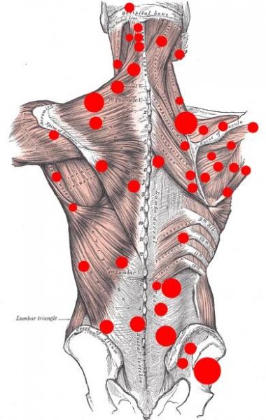 Accurate Education - Trigger Point Therapy
