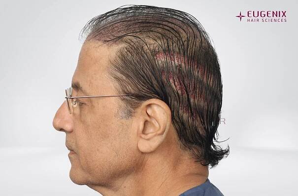 Arun Govil Right Post - Op