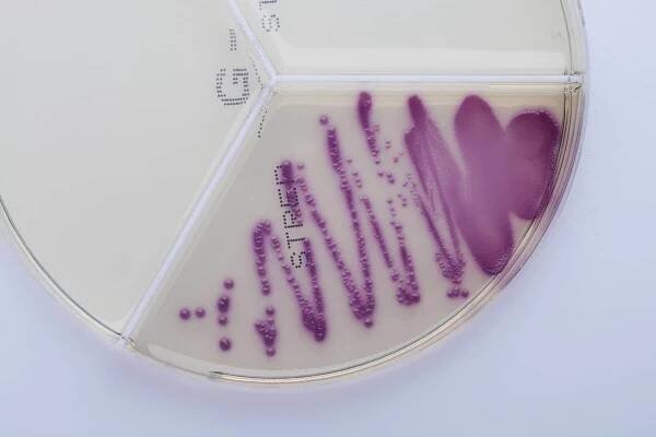Enterococcus faecalis