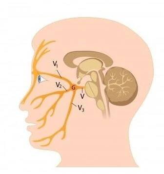 Neuralgie trigeminu: příčiny, příznaky, diagnostika a léčba