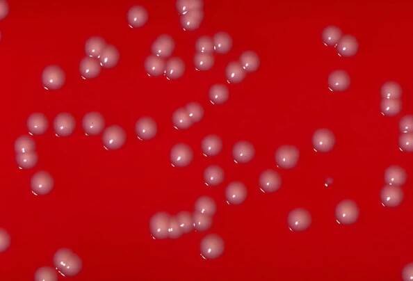 Corynebacterium