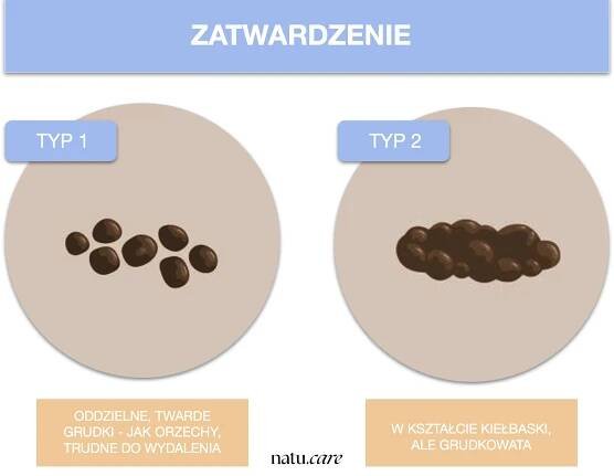 Co říkají vaše hovínka? Záleží na vzhledu, tvaru a barvě vaší stolice.