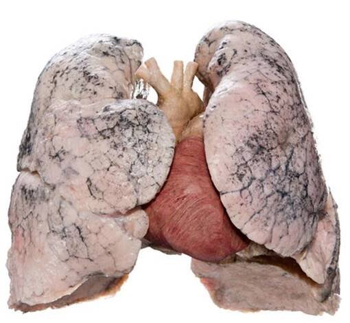 Silicone Plastinates | von Hagens Plastination | Anatomic Excellence