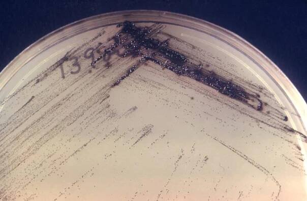 Corynebacterium diphtheriae