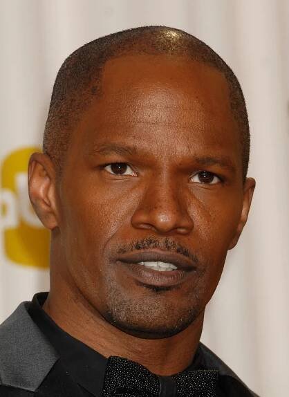 50 Celebrities Who Have Had Hair Transplants