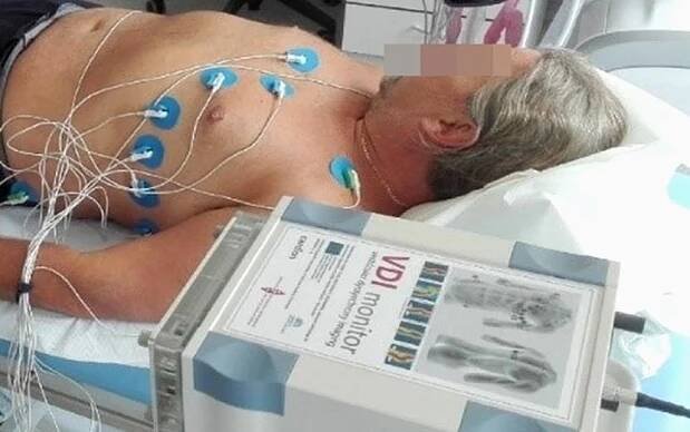EKG