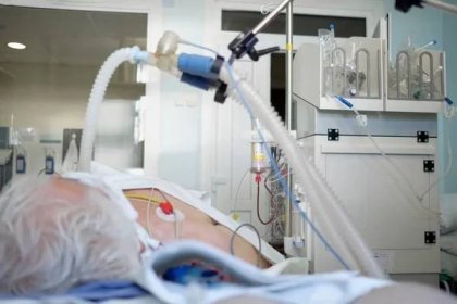 Pacient s koronavirovou pneumonií v kritickém stavu. Intubovaná seniorka pod ventilátorem ležící v kómatu na oddělení intenzivní péče. — Stock obrázek