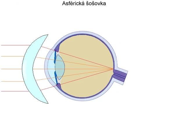 Asférická šošovka