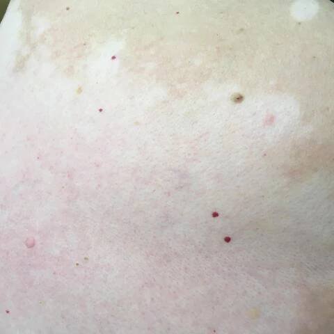 Blog | Dermaweb