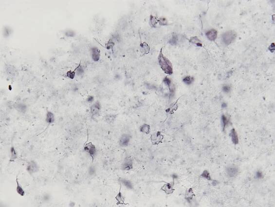 Trichomonády – Príma receptář.cz