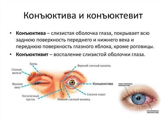Конъюнктивальный мешок глаза: где находится нижняя и верхняя полость, фото, функции