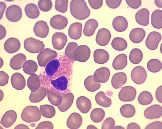 Eosinofilní granulocyt – Wikipedie