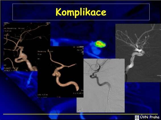 PPT - Naše zkušenosti s léčbou AN PowerPoint Presentation, free download - ID:4308673