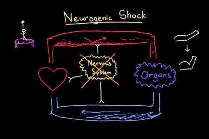 Neurogenní šok: co to je, jak jej diagnostikovat a jak pacienta léčit