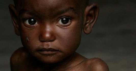Somálsko, Keňa a Etiopie jsou na pokraji hladomoru. Ke konci roku může zemřít 2500 lidí denně, tvrdí OSN