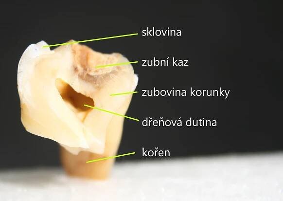 Zuby | MjUNIon