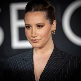 Ashley Tisdale Opened Up About Her Alopecia Diagnosis — See Video