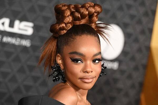 Marsai Martin Suffered 'Debilitating Pain' Before Having 'Grapefruit-Sized' Ovarian Cyst Removed