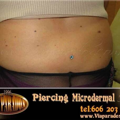Microdermal - Via Paradox