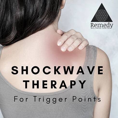 Shockwave Therapy for Trigger Points