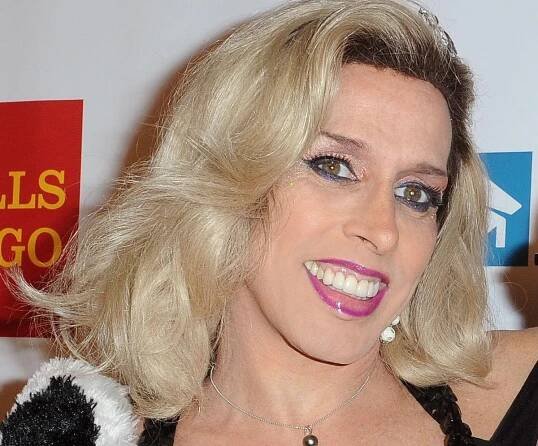 Alexis Arquette's death certificate shows she lived with HIV for 29 years