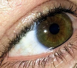 střed obou očí je zelený vnější tmavě modrý mé pravé oko má hnědý pruh. Hazel nebo centrální heterochromie? : heterochromie