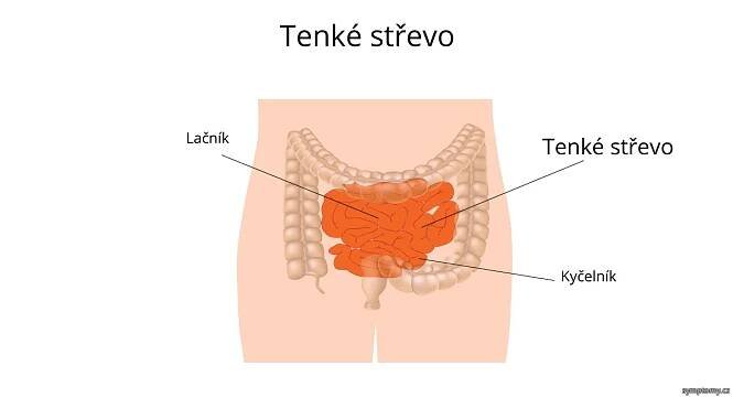 Tenké střevo - příznaky a léčba