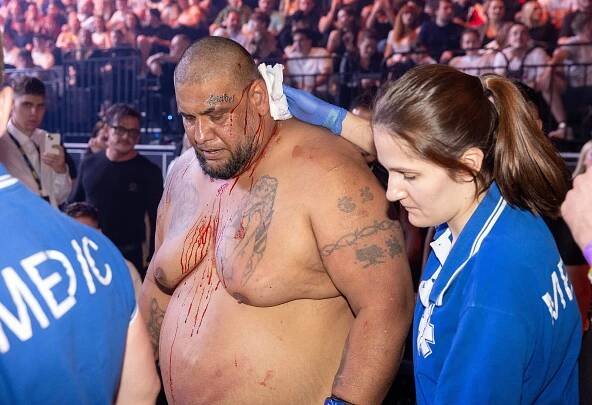 Žloutenka v Clash of the Stars? Zápasník Kotlár útočí na organizaci, vedení reaguje: Je to lhář!